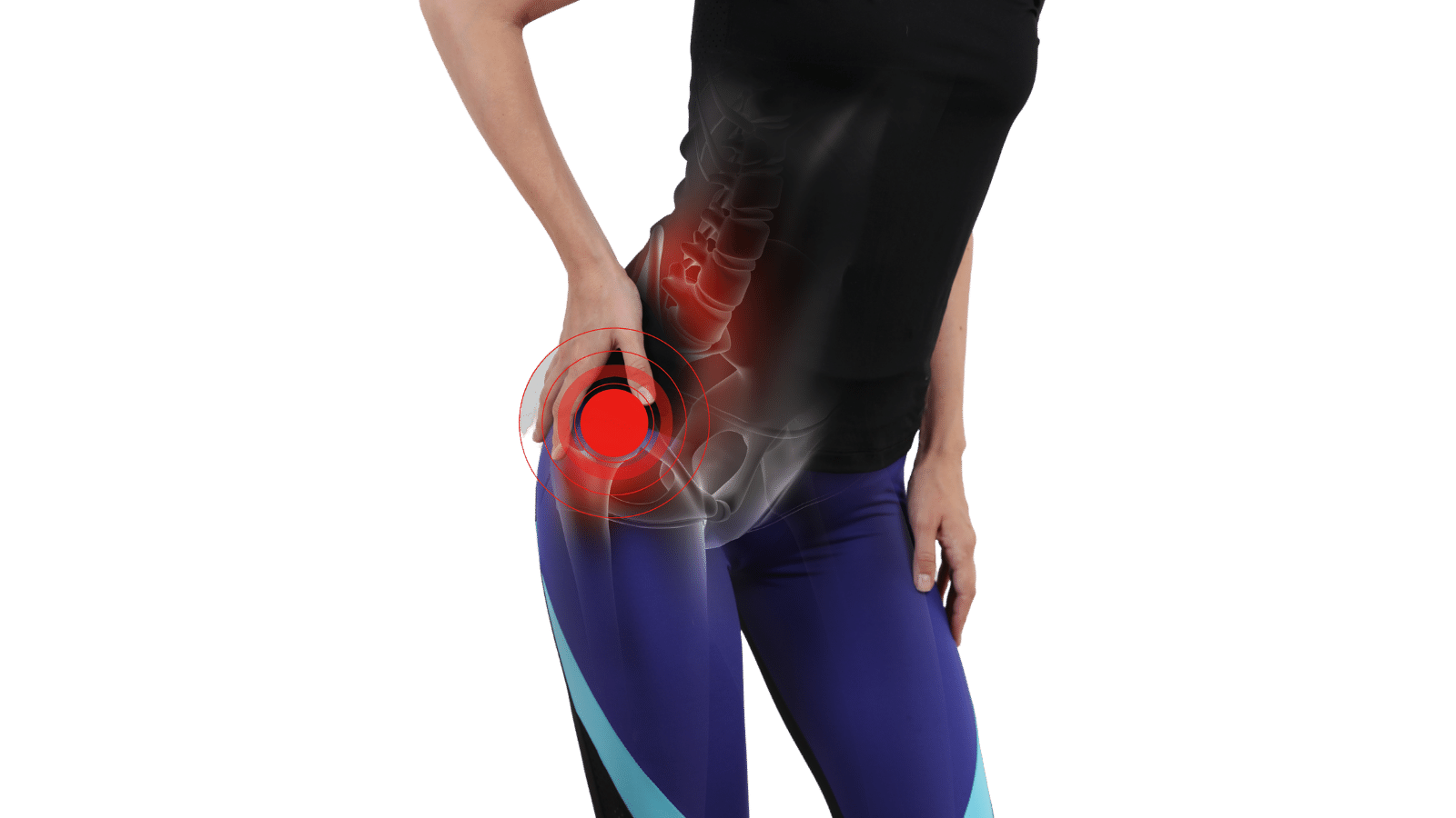 hip labral tear